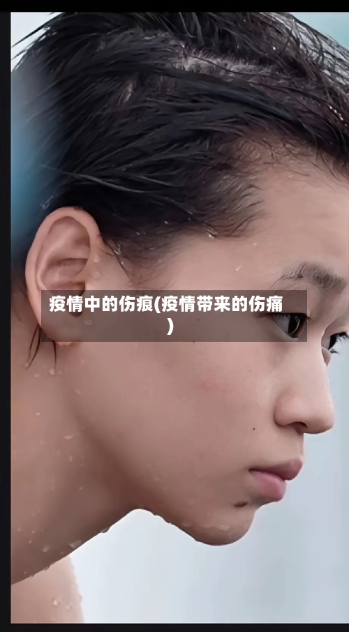 疫情中的伤痕(疫情带来的伤痛)-第3张图片