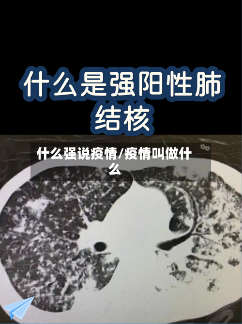 什么强说疫情/疫情叫做什么-第2张图片