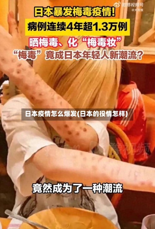 日本疫情怎么爆发(日本的役情怎样)