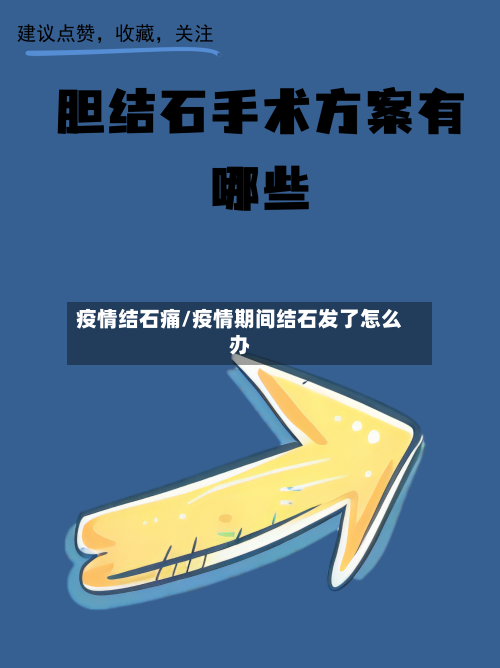 疫情结石痛/疫情期间结石发了怎么办-第3张图片