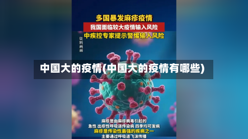 中国大的疫情(中国大的疫情有哪些)