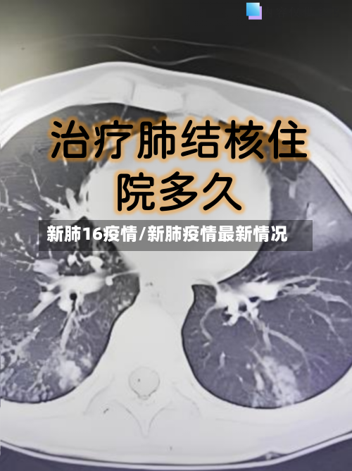 新肺16疫情/新肺疫情最新情况