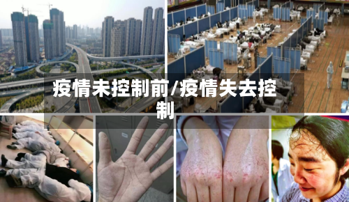 疫情未控制前/疫情失去控制-第2张图片