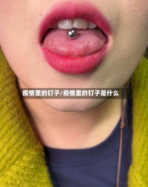 疫情里的钉子/疫情里的钉子是什么