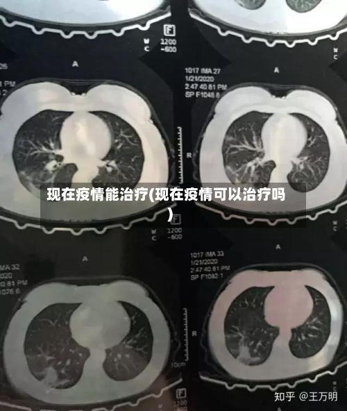 现在疫情能治疗(现在疫情可以治疗吗)