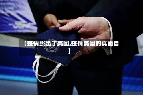 【疫情照出了美国,疫情美国的真面目】-第3张图片
