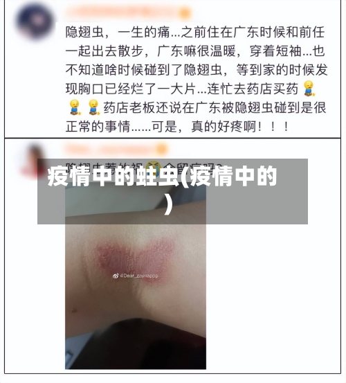 疫情中的蛀虫(疫情中的)-第2张图片